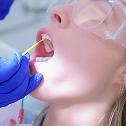 Dental fluoride applied to child’s teeth