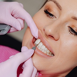 Woman at consultation for veneers