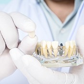 Calimesa implant dentist holding final restoration for dental implant